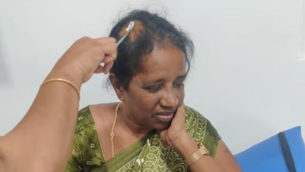 அமர் பிரசாத் ஆள்வச்சு அடிச்சாரு..தலையில் தையலுடன் பாஜக பெண் நிர்வாகி சகோதரி! சென்னை போலீசில் புகார்