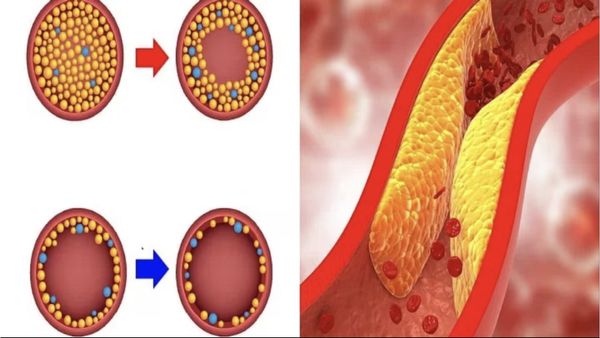 புஸ் புஸ்ஸூனு உடம்பா? அப்ப 