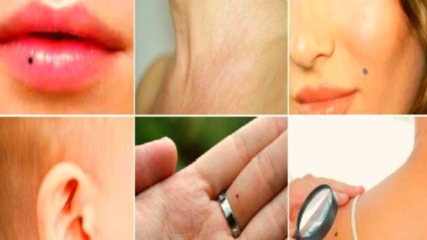 மச்ச சாஸ்திரம்.. உள்ளங்கையில் மச்சம் இருக்கா? உதட்டில் மச்சம் இருக்கா? வியப்பூட்டும் பலன்களை பாருங்க