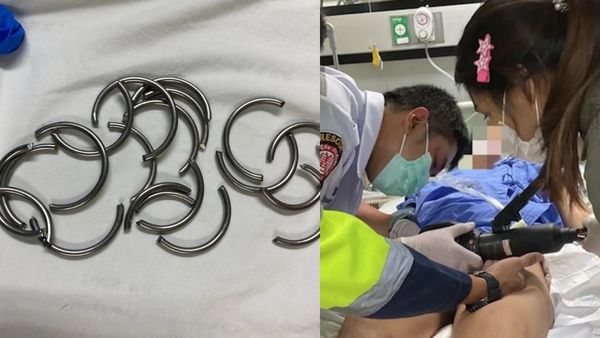 விபரீத ஆசை! பாலியல் சுகத்திற்காக 11 ரிங்க் மாட்டிய நபர்.. வீங்கிய அந்தரங்க உறுப்பு.. ஷாக் சம்பவம்