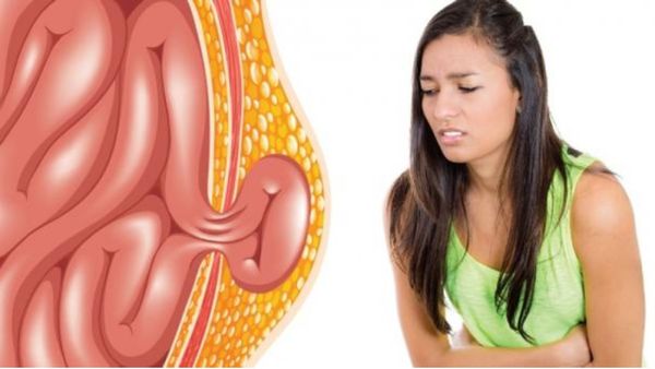 மஞ்ச மஞ்சளா தொப்புளில் அழுக்கு வருதா? தொப்புளுக்கு உப்பு கரைசல் போதுமே.. சூப்பர் டிப்ஸ் பாருங்க