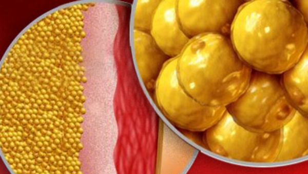 அடிவயிறு தொப்பையை குறைக்க.. இந்த 3 பொருள் போதுமே.. கடகடன்னு கொழுப்பு குறையும்.. சூப்பர் டிப்ஸ்கள்