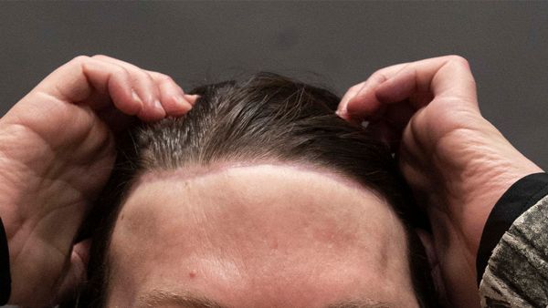 மக்களே உஷார்.. முடிக்கு ஆசைப்பட்டு உயிர் பலியான டிவி பிரபலம்.. வலைவிரிக்கும் ஆபத்து!