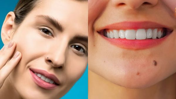 வலது மூக்கில் மச்சம் இருந்தால் 