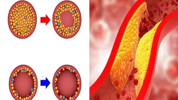 கெட்ட கெட்ட கொழுப்பை கரைச்சிடும் பூசணிக்காய்.. ஜஸ்ட் 1 டம்ளர் வெண்பூசணி ஜூஸ்.. சர்னு குறையும் வெயிட்