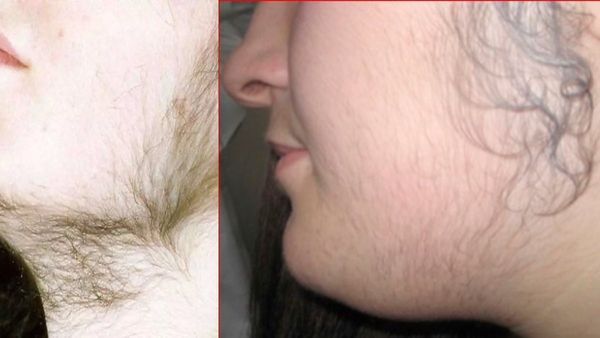 பப்பாளி பழம்.. முகத்தில் 