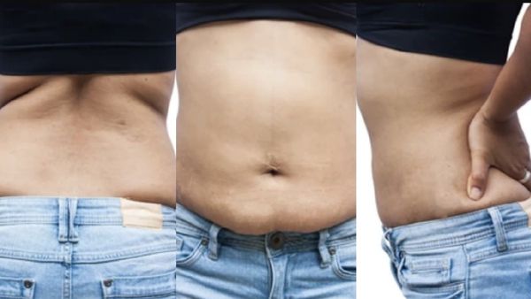 இடுப்பு கொழுப்பு கரையணுமா? காலையில் 