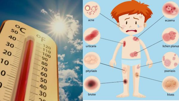 வெயிலுக்கு இதமா ஈர உடை போடுறீங்களா? அப்ப இந்த வியாதி கன்ஃபார்ம்! டாக்டர்கள் எச்சரிக்கை