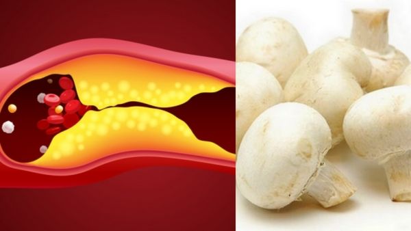 கிடுகிடுன்னு ஆடும் பற்கள்.. வலுவிழந்த எலும்பு.. உடல் எடையை குறைக்கும் காளான்.. கர்ப்பிணி சாப்பிடலாமா