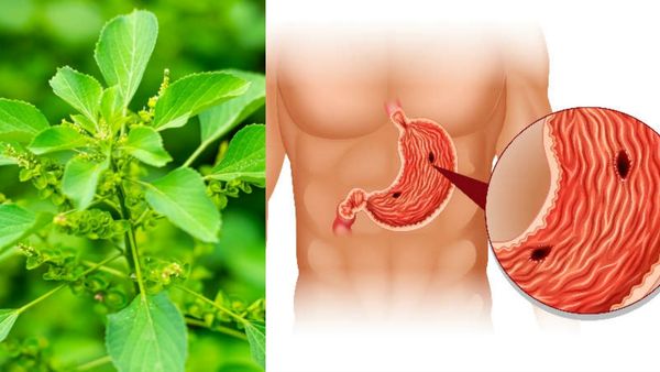 குப்பைமேனி ஸ்பெஷாலிட்டி.. வயிறு புண்களை ஆற்றும் சூப்பர் பழம்.. குடல் புண்ணை நீக்கும் ஜிலீர் டிப்ஸ்