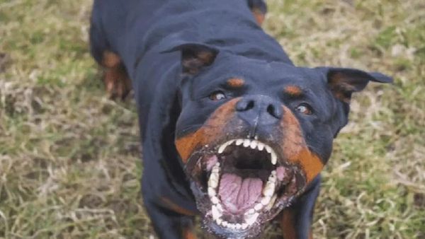 சென்னையில் ராட்வைலர் நாய் கடித்த சிறுமி எப்படி இருக்கிறார்? டாக்டரை பார்த்தாலே அழும் சோகம்