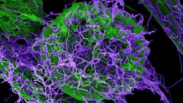 தீவிர பாதிப்பை ஏற்படுத்தும்.. புது வகை எபோலா வைரசை உருவாக்கி டெஸ்ட்.. அதிர வைத்த சீன விஞ்ஞானிகள்