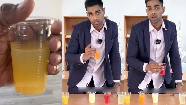 சிறுநீர் எந்த நிறத்தில் வருகிறது? 