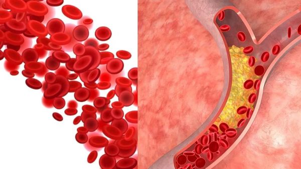 தொப்புளில் கொழுப்பு.. ஆண்களை பாடாய் படுத்தும் தொப்பை.. பெண்களுக்கு ஏற்படும் தொல்லை.. இதுதான் காரணமா?