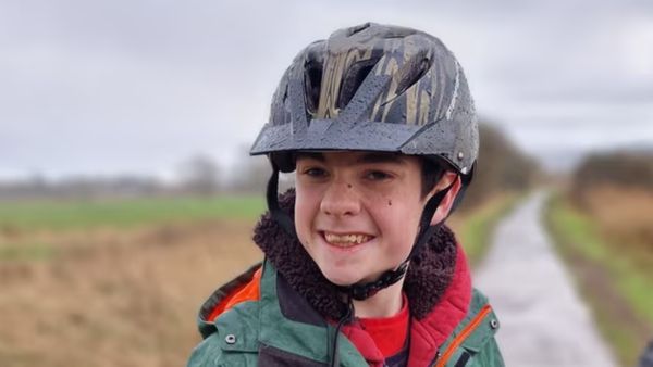 உலகின் முதன் முறையாக.. சிறுவனின் மூளையில் வலிப்பு நோய் கட்டுப்பாட்டு கருவி பொருத்தம்! மருத்துவ சாதனை