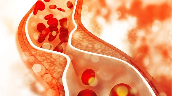 தோளில் வலி.. விரலில் பிடிப்பு.. கெட்ட கொழுப்பை கரைக்கும் பெஸ்ட் உணவுகள்.. இலவங்கப்பட்டை இருக்கா? பலே