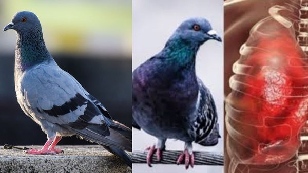 புறாக்கள் எச்சம்.. பறவை வளர்த்தால் இதை மட்டும் செய்யாதீங்க.. நுரையீரலை காலி செய்யும் புறாவின் எச்சம்