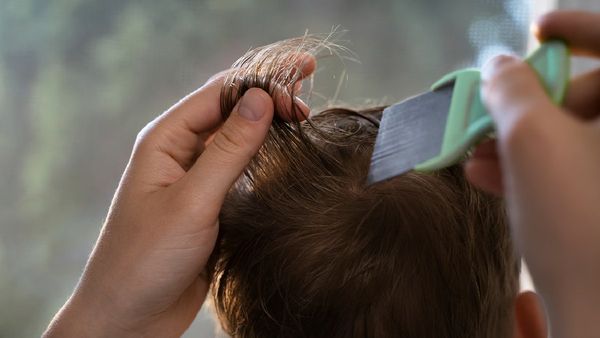 பெண்களே தலையில் பேன் பார்க்கும் போது இந்த தவறை மட்டும் செய்யாதீர்கள்!