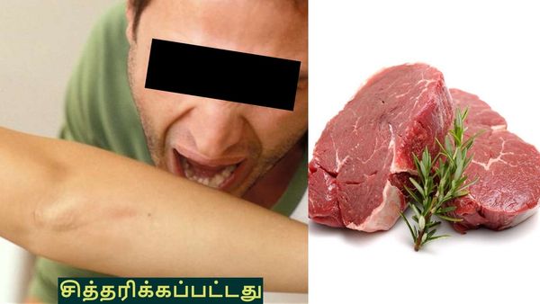 பச்சைக் கறி உணவு, மனிதர்களைக் கடிக்கும் நபர்.. மத்தியப்பிரதேசத்தில் ஒரு மிருதன்