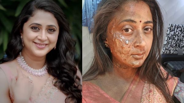 எதிர்நீச்சல் கனிகாவிற்கு என்ன ஆச்சு? முகம் எல்லாம் இப்படி இருக்கே! அவரே கொடுத்த விளக்கம்