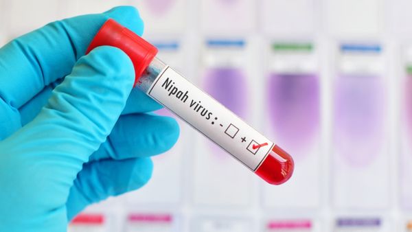 மேலும் இருவருக்கு நிபா வைரஸ் பாதிப்பு.. அலறும் கேரளா! தொற்று பரவல் தடுப்பு நடவடிக்கை தீவிரம்!
