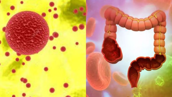 ஆசனவாயில் இரத்தமா.. மூலநோய்க்கு காரணம் இதுவா? பைல்ஸ் வராமல் தடுக்கும் ஆரோக்கிய உணவு.. மூலம் அண்டாது