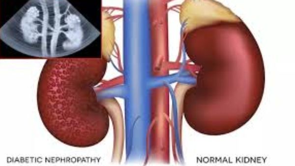 தூத்துக்குடியில் விரால் மீன் துள்ளுது.. மீன்வளக் கல்லூரி தந்த ஹேப்பி நியூஸ்.. செம சான்ஸை விடாதீங்க