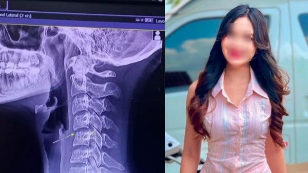 மசாஜ் செய்ததால் வந்த வினை? நடக்க முடியாமல் பரிதவித்த பாப் பாடகி பலி! மருத்துவர்கள் சொல்வது என்ன?