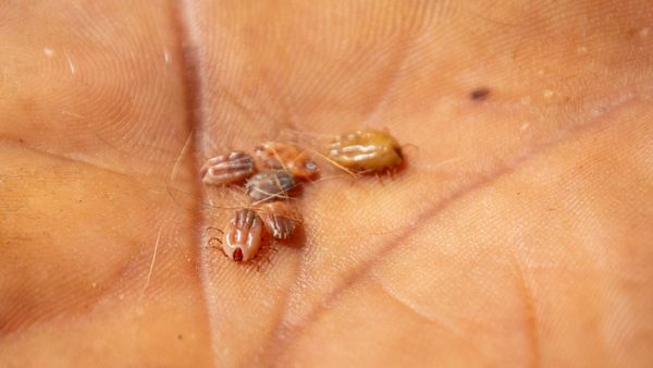 தமிழகத்தை அச்சுறுத்தும் உண்ணி காய்ச்சல்.. இருவர் உயிரிழப்பு! அறிகுறிகள் என்ன! சிகிச்சை என்ன?