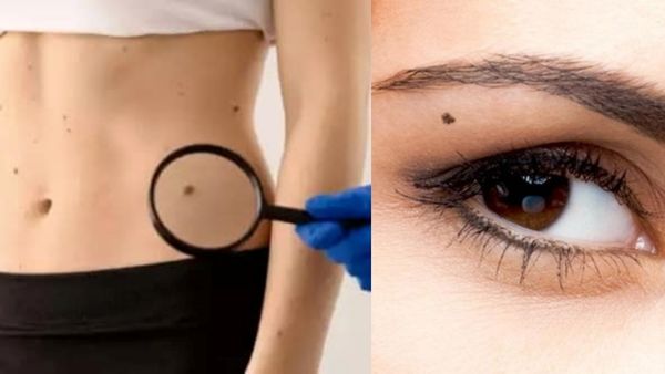 மச்சங்களும், அர்த்தங்களும்.. இடுப்பில் மச்சம் இருக்கா? எப்பவும் யோகம்தான் போங்க! இவங்க மட்டும் கவனம்