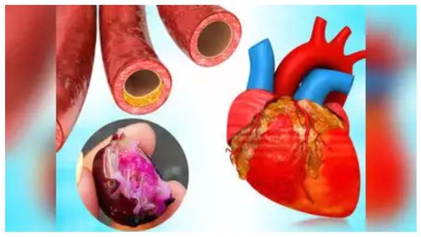 6 x 6 x 6 ஈஸியான வாக்கிங் விதி.. நடைபயிற்சியால் இத்தனை நன்மைகளா? தினமும் எத்தனை ஸ்டெப்ஸ் நடக்கணும்?