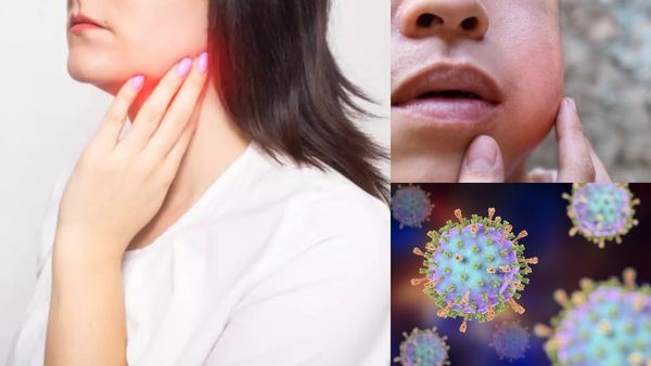 புதிய பிரச்சினை.. ஒருவரிடம் இருந்து 12 பேருக்கு பரவும் பொன்னுக்கு வீங்கி.. எச்சரிக்கும் Dr.சரவணன்..!