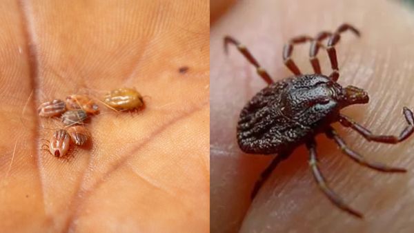 அச்சுறுத்தும் உண்ணி காய்ச்சல்.. தமிழகத்தில் அடுத்தடுத்து பலருக்கு பாதிப்பு! அறிகுறி & சிகிச்சை என்ன?