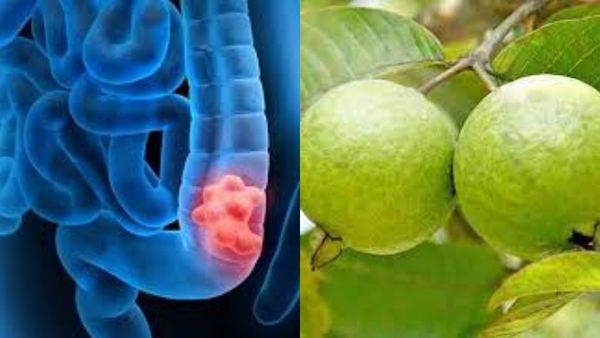 எந்தெந்த நேரத்தில் கொய்யாப்பழம் சாப்பிடலாம்.. பெருங்குடல் புற்றுநோய் அண்டாது! கொய்யா பெஸ்ட் நன்மைகள்