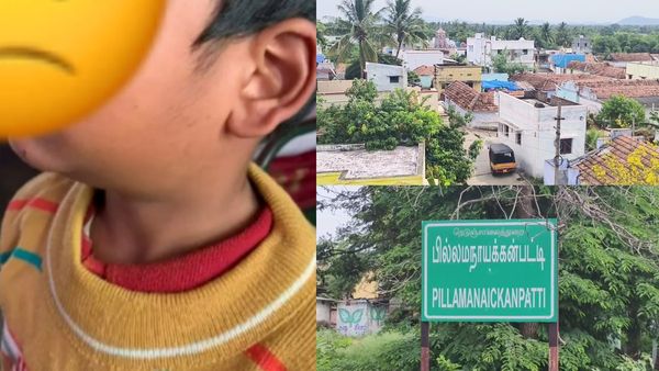 ஒரே ஊரில் 100 பேருக்கு கழுத்து வீக்கம்.. MUMPS பாதிப்பு! காத்திருக்கும் ஆபத்து? அம்மை என அலட்சியம்!