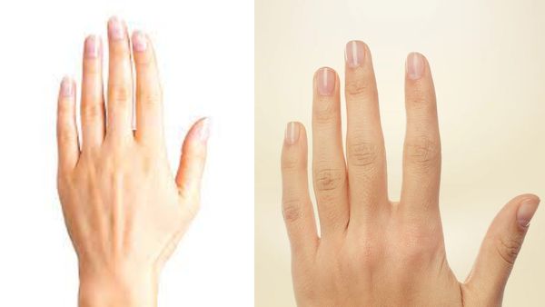 Blood group ஐ விடுங்கள்! உங்கள் கை விரல் நீளத்தை வைத்தே நீங்கள் யாருனு சொல்லிடுவோமே!