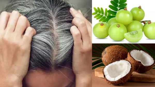 நரை முடியை கருப்பாக்கும் நெல்லிக்காய் + தேங்காய் எண்ணெய்! 7 நாளில் முடி கொட்டுதலுக்கு ஃபுல்ஸ்டாப்!