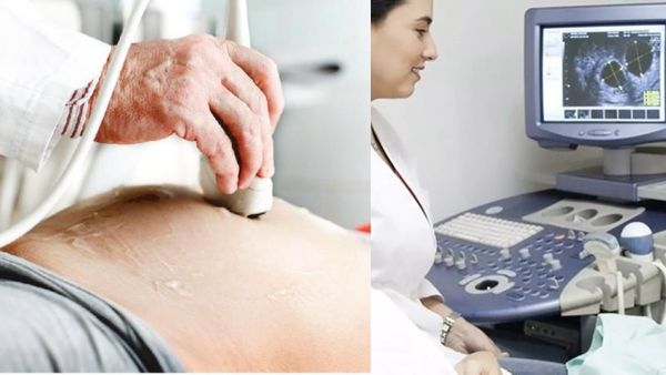 அல்ட்ரா சவுண்ட் ஸ்கேனின் போது 7 வார குழந்தைக்கு இதயதுடிப்பு இருக்காதது ஏன் தெரியுமா?