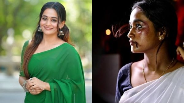 பாண்டியன் ஸ்டோர்ஸ் நடிகையா இது? முகமெல்லாம் இப்படி இருக்கு! பீல் பண்ணும் ரசிகர்கள்