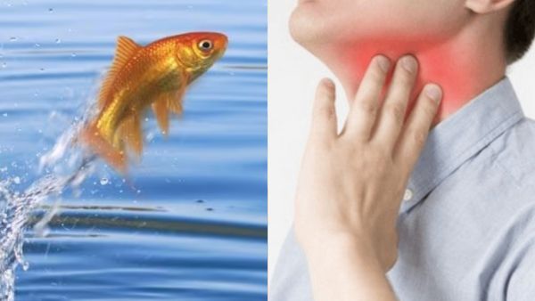 சென்னை இளைஞரின் தொண்டைக்குள் திடீரென்று பாய்ந்த மீன்.. கடைசியில் பெரும் சோகம்.. என்ன நடந்தது?