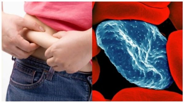 கெட்ட கொழுப்பை கரைக்க உதவும் பால்.. அடிவயிறு கொழுப்பு, ஹை கொலஸ்ட்ரால் சர்ரென குறைய வெற்றிலை போதுமே