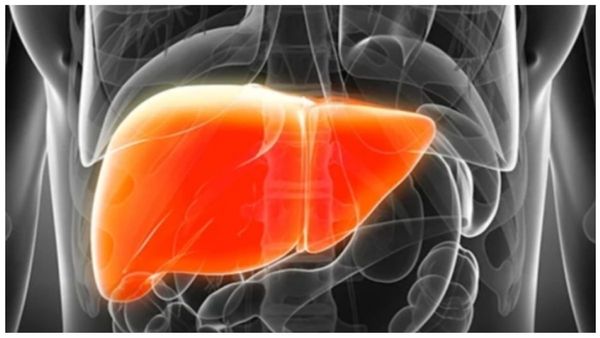 Fatty Liver Symptoms: கொழுப்பு கல்லீரல் ஏற்பட காரணம் இதுதானா? லிவரை பாதுகாக்கும் சூப்பர் உணவு லிஸ்ட்