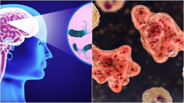 மூளையை தின்னும் அமீபா.. தொற்று கண்டறியப்பட்ட 5 நாட்களில் மரணம்! எச்சரிக்கும் மருத்துவர்கள்