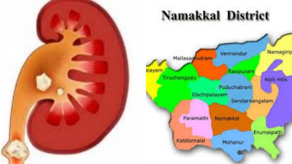பல்லிளிக்குது பள்ளிப்பாளையம்.. 1 கிட்னி ரூ.10 லட்சம்? நாமக்கல் மக்களின் வயிற்றில் அடித்த அரசியல்வாதி