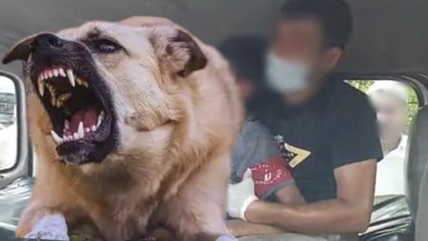 கொஞ்சம் லேட்டானாலும் உயிர் போயிடும்! நாய்க்கடியை சாதரணமாக நினைக்க கூடாது! மக்களுக்கு பறந்த வார்னிங்