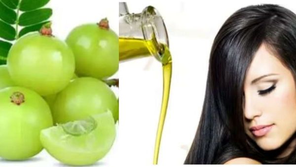 கத்தைக் கத்தையாய் தலைமுடி வருதா? நெல்லிக்காய் சோறு, நெல்லி லட்டு போதுமே.. கொட்டும் தலைமுடிக்கு தீர்வு