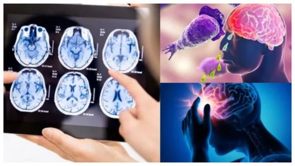 கேரளாவை அலறவிடும் மூளையைத் தின்னும் அமீபா.. தொடரும் உயிர் பலிகள்.. நீர்நிலைகளில் ரொம்ப கவனம்