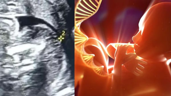 பிறந்த குழந்தையின் வயிற்றில் கரு.. கர்நாடகா அரசு மருத்துவமனையில் விநோதம்.. வியந்து நின்ற டாக்டர்கள்