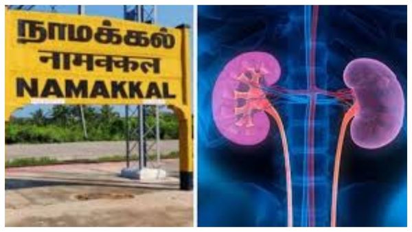 நாமக்கல் கிட்னி திருட்டு.. இரவோடு இரவாக புரோக்கர்கள் இருவர் கைது! பரபரக்கும் விசாரணை