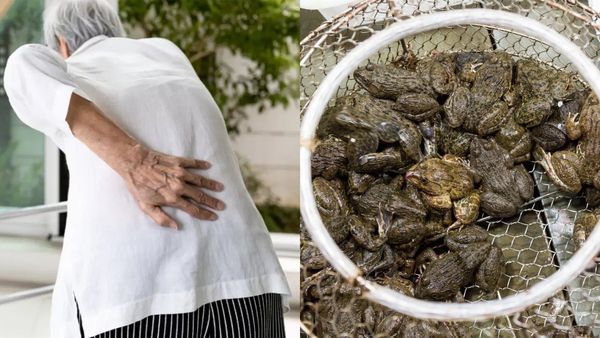 முதுகுவலிக்காக! 8 தவளைகளை உயிருடன் விழுங்கிய சீனா பாட்டி! வயிற்று வலியால் மருத்துவமனையில் அட்மிட்